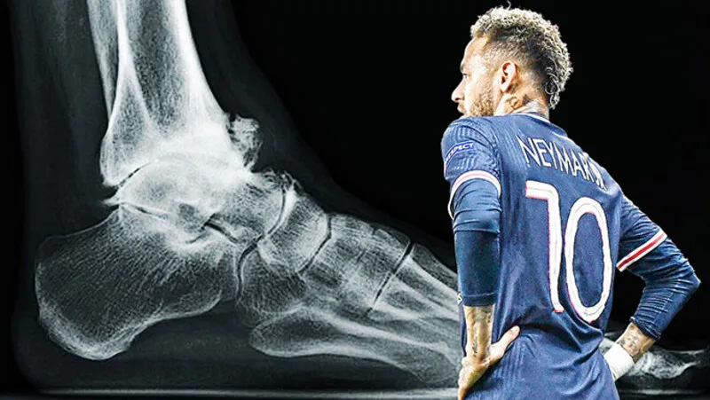 Chấn thương cổ chân lặp lại là một trong những vấn đề dai dẳng nhất trong sự nghiệp Neymar, đặc biệt ở giai đoạn PSG.